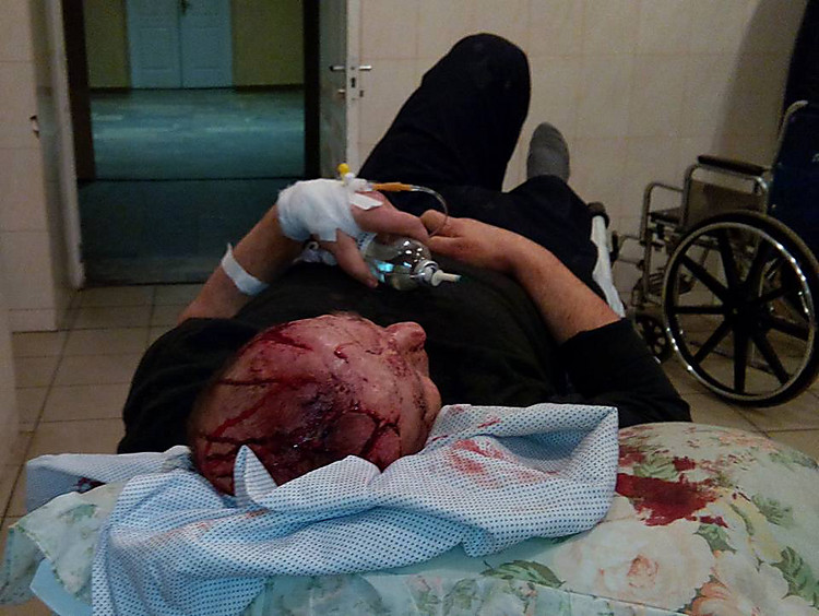 В Кривом Роге проломили голову журналисту местной газеты