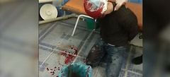 Мужчина, пострадавший в драке в центре Одессы, напал на врачей «скорой помощи», которые пытались оказать ему помощь
